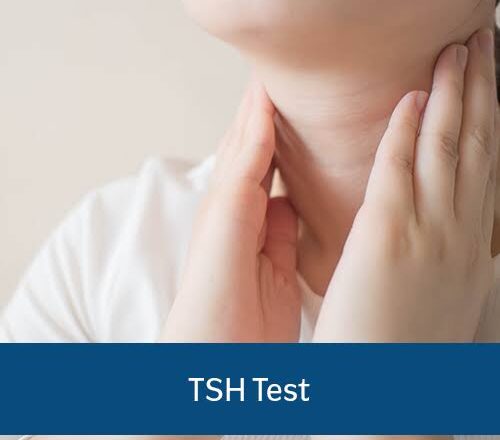 Thyroid Test at Home: A Comprehensive Guide to Monitoring Your Thyroid Health