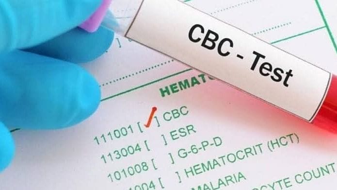 Signs You Require a CBC Test